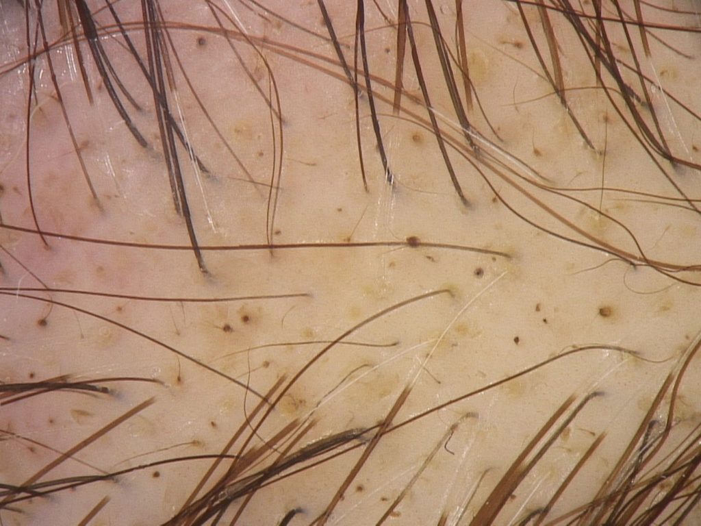La Tintura per capelli può danneggiare i follicoli?